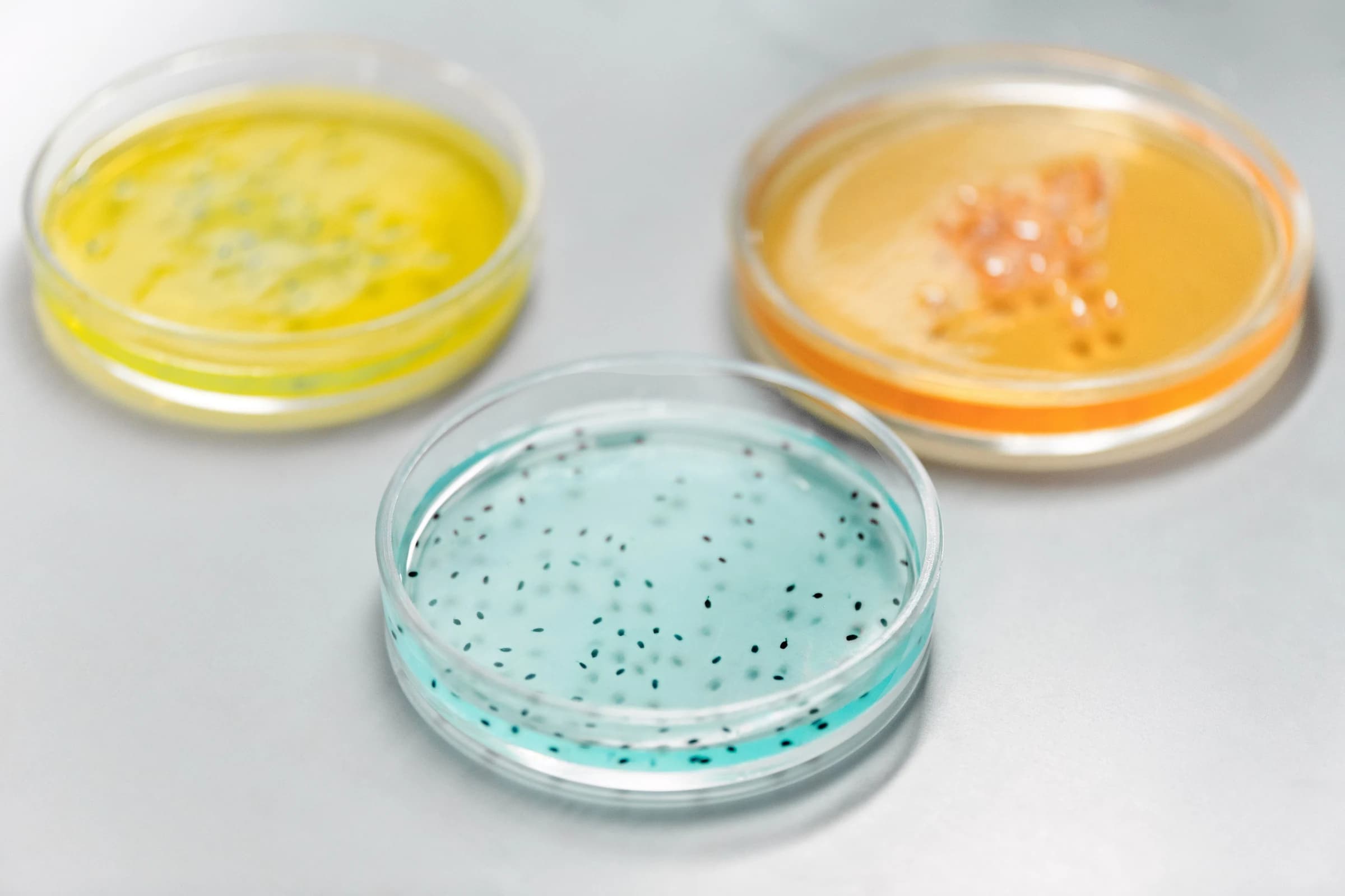 Petri dishes containing culture media of different colours